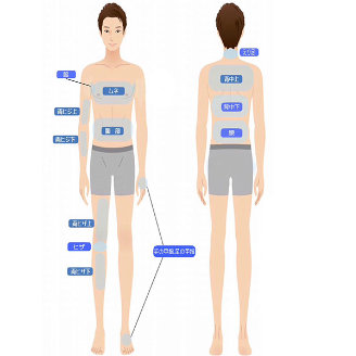 全身脱毛6回部位一覧